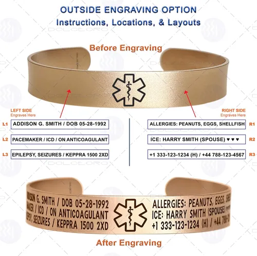 Vista 17 de Pulsera de identificación de alerta médica, acero inoxidable 316L, personaliza y personaliza, selecciona un tamaño de muñeca, de 6 a 9 pulgadas
