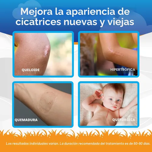 Vista 3 de Gel de Cicatrización de Silicona para Niños ScarAway, 100% de Grado Médico, Ayuda a Mejorar el Tamaño, Color y Textura de Cicatrizes Hipertrofias