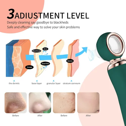 Vista 4 de 2025 - Aspiradora de poros para eliminar puntos negros, limpiador de poros facial recargable visual, 3 succiones de silicona suave, 3 sondas, kit
