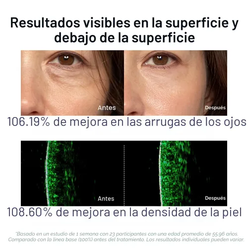 Vista 5 de SUNGBOON EDITOR Suero Rellenador de Arrugas de Colágeno Profundo Volufiline + Colágeno + Niacinamida Reafirmante, Cuidado de Arrugas