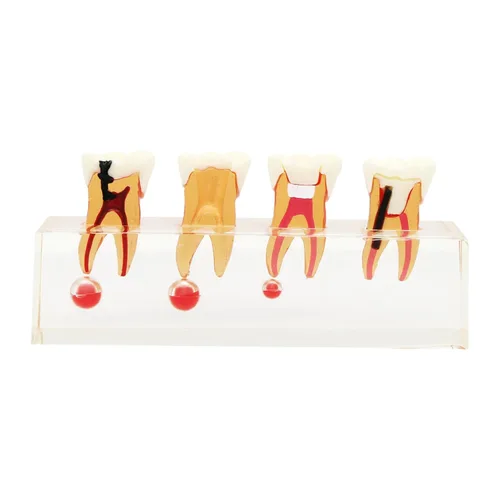 Vista 7 de Modelo de tratamiento endodóntico Dentalmall, de cuatro etapas, para enseñar a estudiantes, modelo 4018