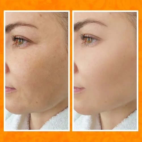 Vista 3 de Bee and You - Suero facial con vitamina C Hidratante antienvejecimiento, reduce la apariencia de manchas oscuras, iluminador de piel brillante