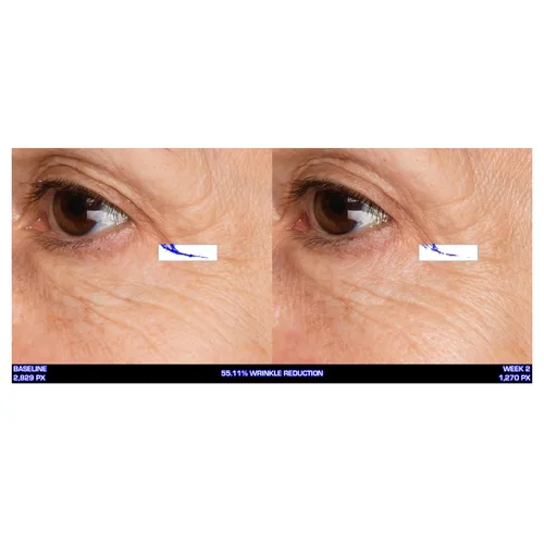 Vista 2 de Serious Skincare - Ultra-Mare Pure Marine Infusion Crema revitalizante para ojos - Péptidos - Renovación de la piel - Fomenta la producción