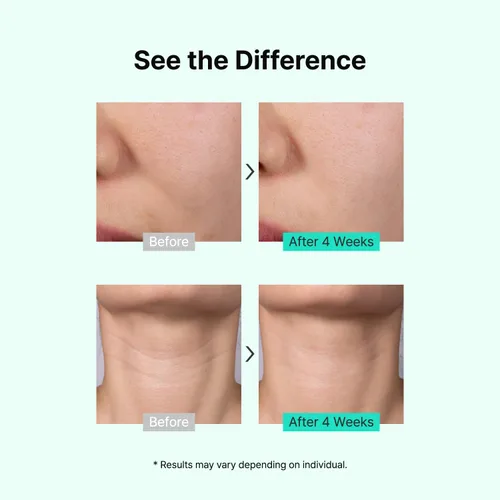 Vista 5 de TIAM Vita A Bakuchiol Suero juvenil, 1.35 onzas líquidas, suero antienvejecimiento para arrugas y manchas oscuras, mejora la firmeza y elasticidad