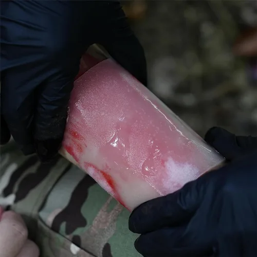Vista 5 de Rhino Rescue Paquete de 5 apósitos de quemaduras de 4 x 4 pulgadas, gel de quemaduras, crema calmante para aliviar quemaduras, suministros