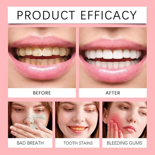Vista 6 de Pasta de dientes probiótica SP10 de 2 piezas, pasta de dientes blanqueadora, fórmula de aliento fresco, eliminación de manchas, cuidado de limpieza