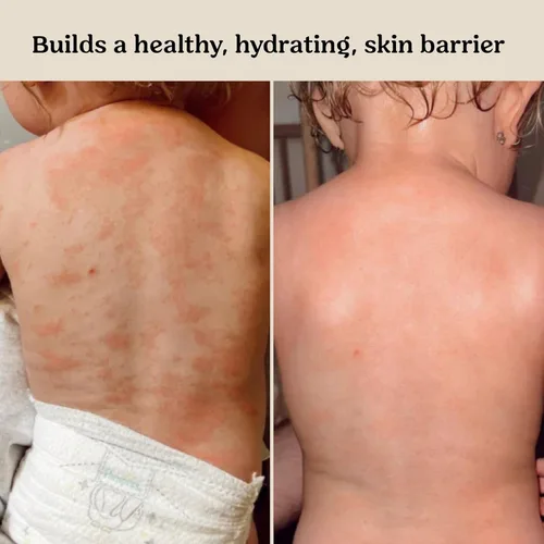 Vista 4 de Roe Wellness - Loción hidratante para bebés sin fragancia Ideal para pieles sensibles Loción hidratante ligera Para bebés, bebés, niños y más
