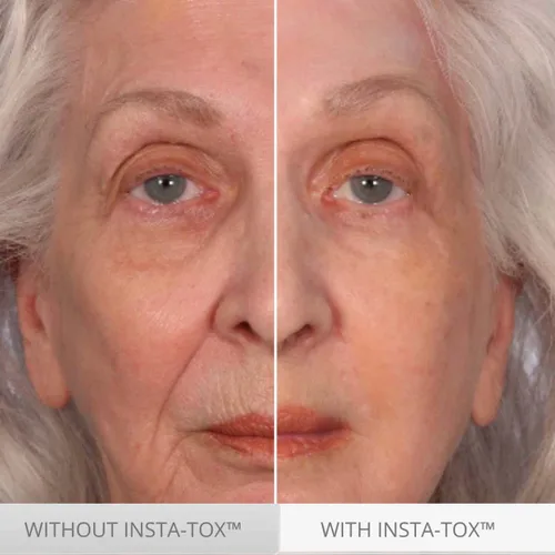 Vista 2 de Serious Skincare INSTA-TOX - Suero instantáneo para la piel, suavizante, aprieta temporalmente la cara, reduce instantáneamente la apariencia