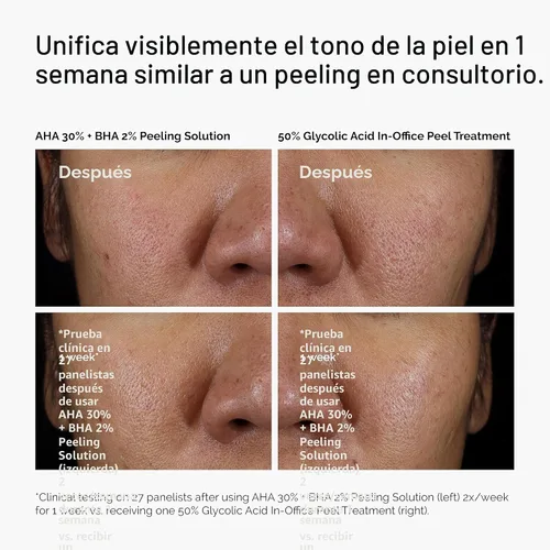 Vista 6 de The Ordinary AHA 30% + BHA 2% Peeling Solution, Advanced Exfoliating Peel for Brighter Skin