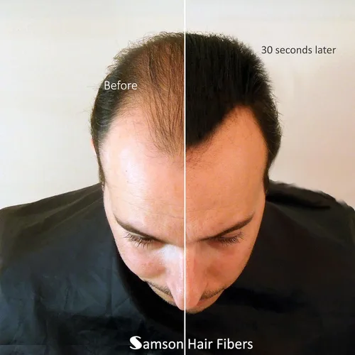 Vista 4 de para cabello adelgazante - Fórmula natural 100% indetectable - Oculta completamente la pérdida de cabello en segundos. Cubre las calvas. Espesa tu