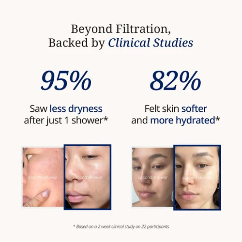 Vista 2 de SecondShower - Filtro clínicamente probado para la salud de la piel, elimina el 99% del cloro y la cloramina, filtración certificada NSF para agua