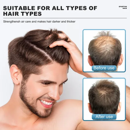 Vista 5 de Champú Activador de Raíces para Hombres - Sistema Fortalecedor y Suavizante para Cabello Fino y Canoso - Añade Volumen y Nutre las Mechas - Para