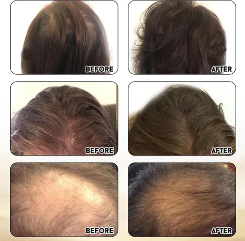 Vista 6 de Joyce Giraud Ultimate Hair Strength Supplements Suministro de 30 días, formulado científicamente para reducir la pérdida de cabello, 60 cápsulas