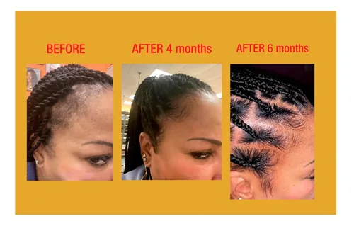 Vista 4 de GOOD2GRO - Acondicionador de crecimiento y engrosamiento de biotina, 8 onzas, fortalece y repara el adelgazamiento del cabello, reduce la rotura