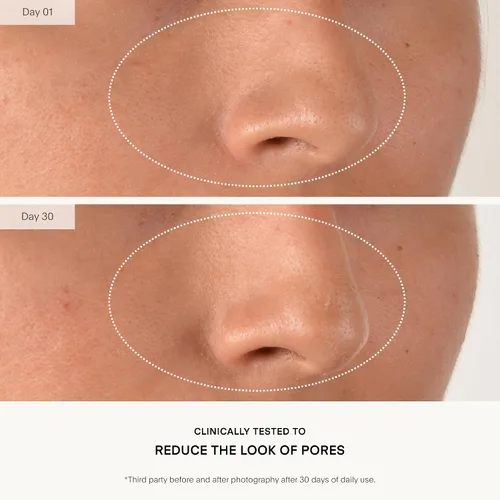 Vista 5 de U Beauty Suero Compuesto Resurfaceador - Renueva e Ilumina el Suero Facial - Fórmula Avanzada 8 en 1 con Vitamina C, Retinol, Ácido Hialurónico