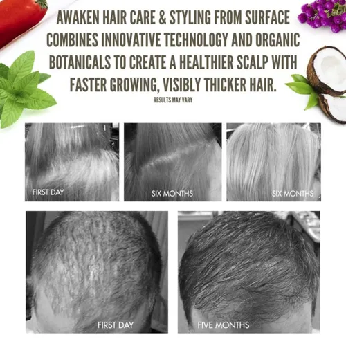 Vista 5 de Máscara terapéutica Surface Hair Awaken