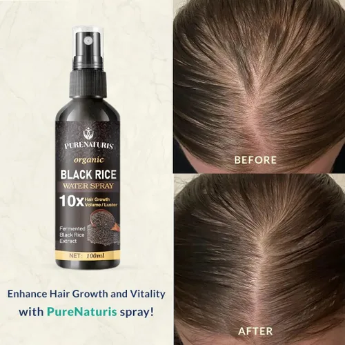 Vista 4 de PureNaturis Aceite de ricino y jengibre para el crecimiento del cabello, suero sin enjuague para hombres y mujeres, eficaz para la pérdida