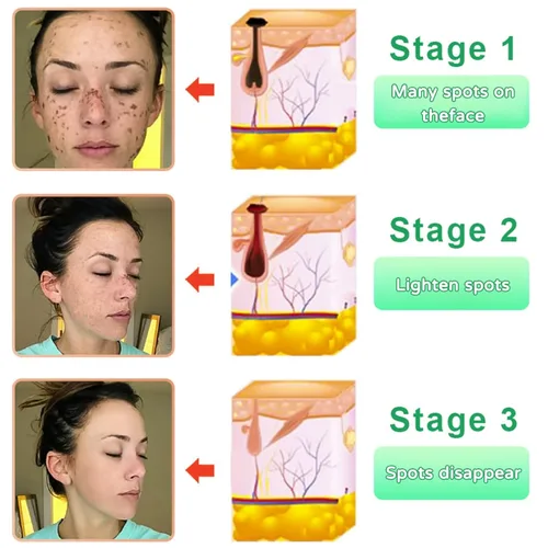 Vista 5 de Gel exfoliante purificador, limpiador facial y exfoliante de limpieza profunda para rostro y cuerpo, hidratante limpia la piel y limpia la suciedad
