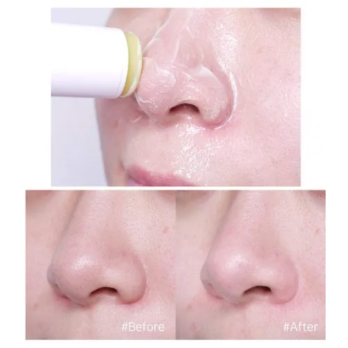 Vista 5 de THESAEM Calamansi Pore Stick Cleanser 0.53 oz - Palo de limpieza profunda de poros para limpiar la piel. Elimina puntos negros y sebo, exfoliando