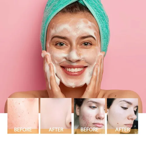 Vista 4 de Axnzp Limpiador facial de cúrcuma, limpieza profunda, exfoliante brillante, lavado facial de cúrcuma con cepillo para todas las mujeres.