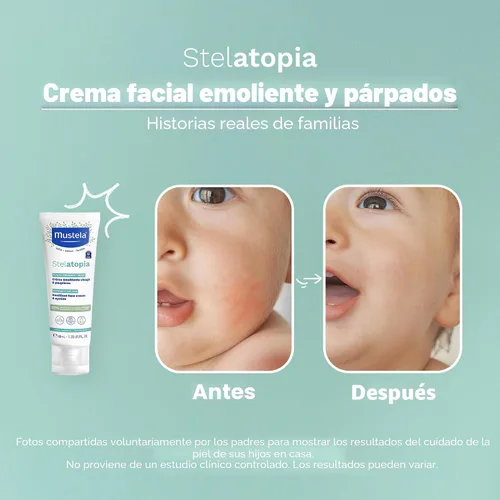 Vista 6 de Mustela Stelatopia Eczema - Crema facial emoliente para la piel del bebé, hidratante facial con aguacate natural y aceite de girasol, sin fragancia