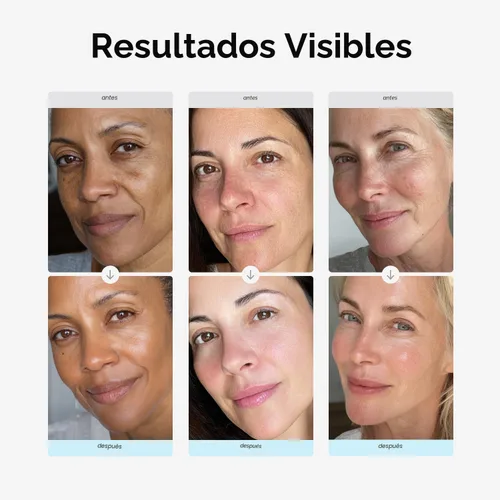 Vista 9 de MAREE Crema hidratante facial con retinol para la cara – Crema diaria de arrugas para mujeres – Crema facial antienvejecimiento – Hidratante facial