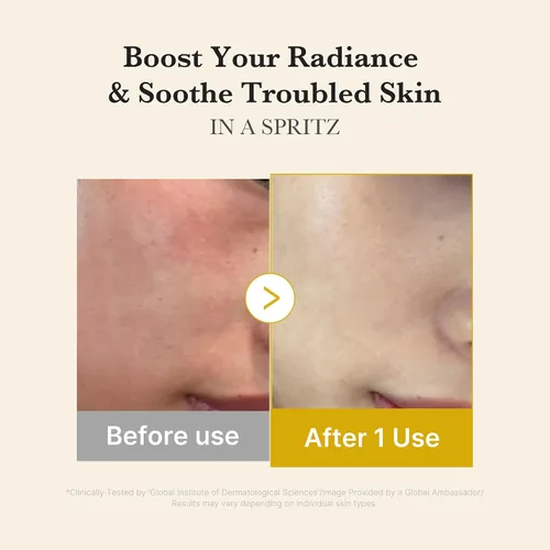 Vista 4 de medicube Suero en Bruma de Gelatina Dorada con Vitamina de Cúrcuma Bruma Facial Diaria 2 en 1 y Suero Con Vitamina C, Cúrcuma, Pantenol para un