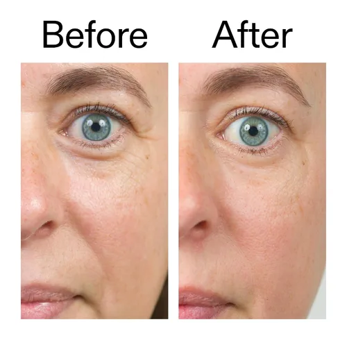 Vista 8 de The INKEY List Crema Hidratante Reparadora y Rellenadora de Ceramidas Bioactivas 1.7 fl oz/50 ml, Cuidado de la Piel Anti-Edad, Crema de Hidratación