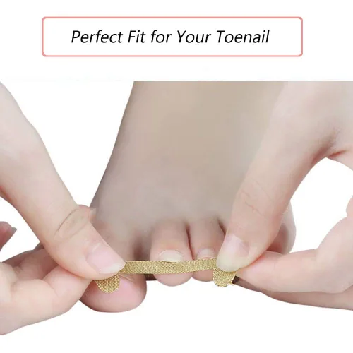 Vista 2 de EBANKU Tiras de tratamiento de uñas encarnadas, 20 piezas de parche de corrección de uñas de los pies, parche elástico, corrector de pedicura