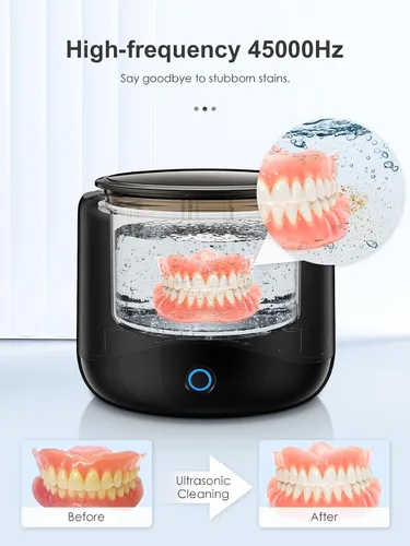 Vista 2 de Limpiador ultrasónico de retenedores, máquina limpiadora de retenedores de 45 kHz para dentaduras, protectores bucales, alineadores, frenos