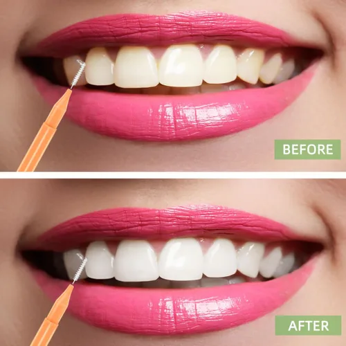 Vista 5 de 75 piezas de cepillos para dientes dentales dentales hilo dental cepillo palillo de dientes para limpieza interdental, herramienta de limpieza