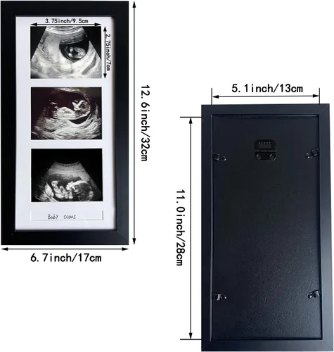 Vista 3 de Marcos de fotos de ultrasonido triple, marco de fotos de sonograma, 3 fotos, anuncios de embarazo, regalos de embarazo para madres primerizas, Negro