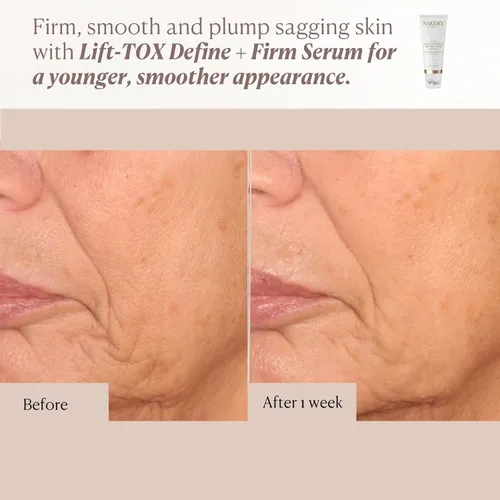 Vista 5 de Nakery Lift-Tox Define & Firm Tratamiento de estiramiento facial con NAD+ y refuerzo de colágeno, rodillo de cuello y mandíbula para piel flácida