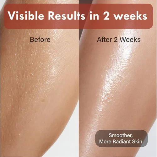 Vista 3 de Loción corporal coreana de frijoles rojos – Hidratante hidratante 24 horas para piel seca con péptidos y ácido hialurónico para pieles suaves
