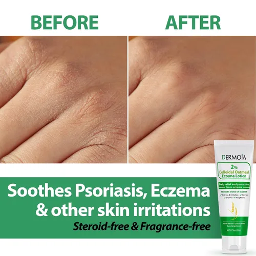 Vista 2 de Loción de eczema de avena coloidal al 2% - Crema calmante e hidratante antipicazón y loción corporal con aloe vera, karité y glicerina, crema