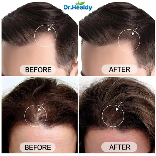 Vista 6 de Dr.Healdy - Champú de aceite de batana para el crecimiento del cabello, contra la pérdida de cabello e hidrata, reduce la rotura, fórmula sin