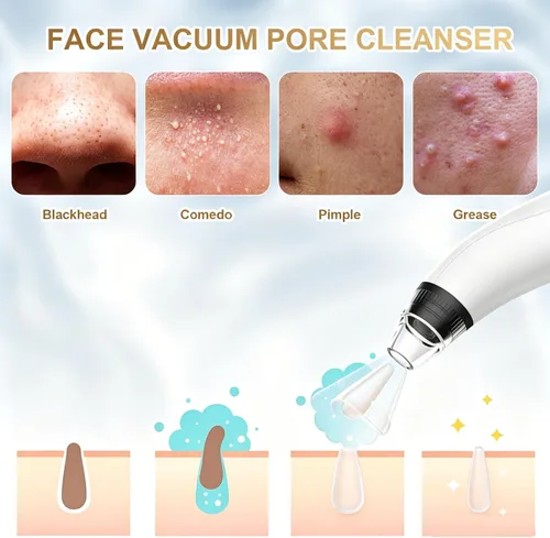 Vista 12 de Blackhead Remover Tools,Electric Vacuum Facial Pore Cleaner Tool(White)