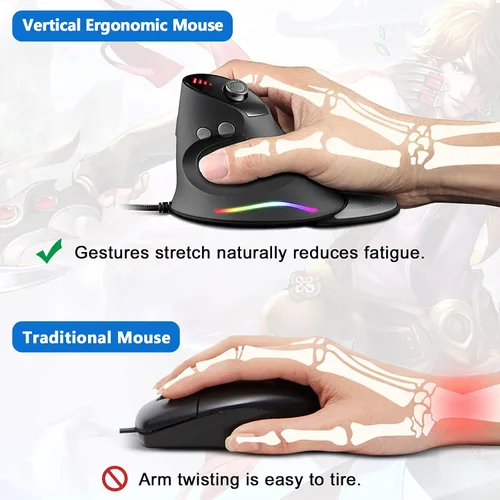 Vista 5 de Mouse para juegos con basculante 5 D, mouse ergonómico TRELC con 10000 DPI12 botones programablesreposamanos, ratones verticales RGB con cable