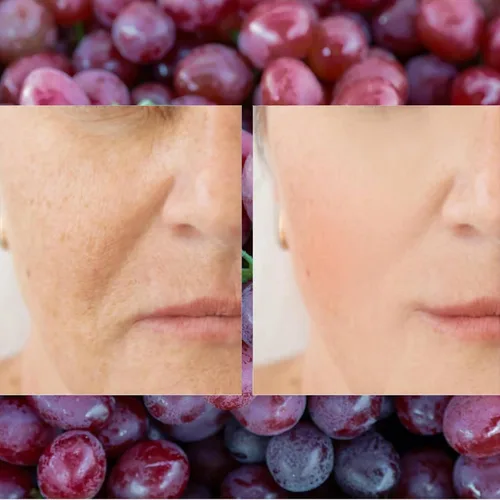 Vista 4 de El factor antioxidante antienvejecimiento del suero de la piel del resveratrol mejora las líneas finas arrugas y elasticidad de la piel Grado