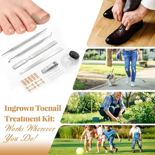 Vista 7 de Kit de eliminación y corrector de uñas encarnadas para un alivio rápido del dolor, kit profesional de tratamiento de uñas encarnadas con tiras