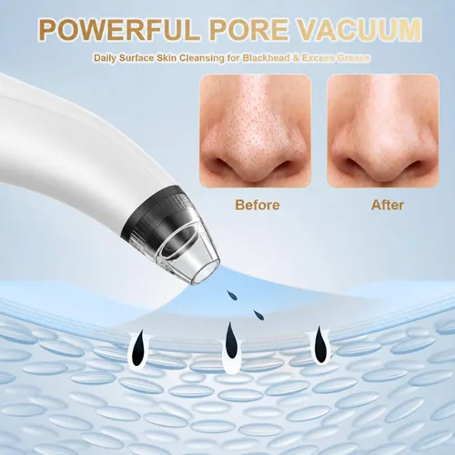 Vista 13 de Blackhead Remover Tools,Electric Vacuum Facial Pore Cleaner Tool(White)