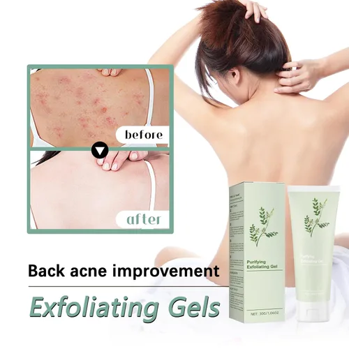 Vista 6 de Gel exfoliante purificador, 2 unidades de gel exfoliante facial y corporal de limpieza profunda, exfoliantes purificadores avanzados, exfoliante