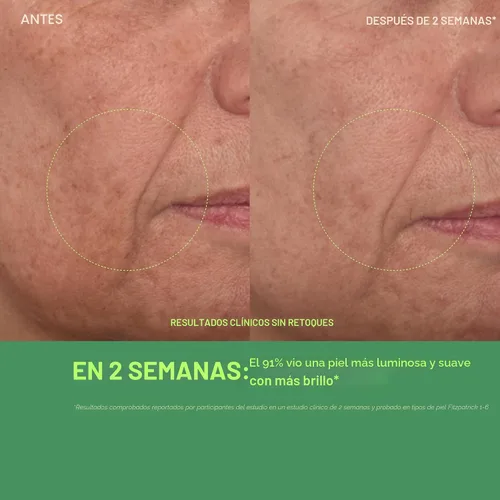 Vista 5 de Murad Vita-C Suero glicólico - Escudo ambiental iluminador de la piel Vitamina C Suero facial - Tratamiento respaldado por la ciencia