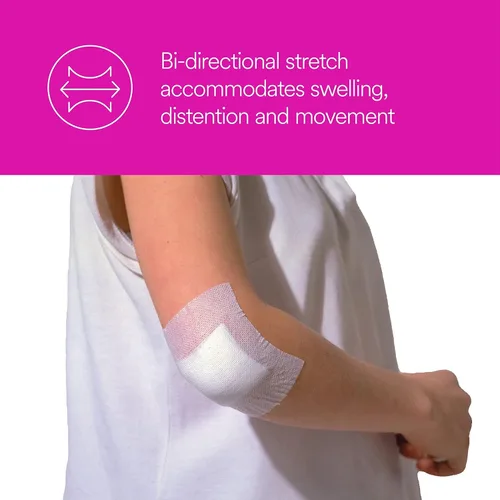 Vista 4 de 3M Healthcare Corp Medipore, cinta quirúrgica de tela suave hipoalergénica, 2 pulgadas X 10 yardas, blanca, excelente adherencia, resistente al