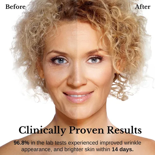 Vista 3 de Lamelin Crema de suero antiarrugas, retinol y bakuchiol y niacinamida, 10 vitaminas y hierbas, antioxidante, corrección de cuello oscuro para ojos