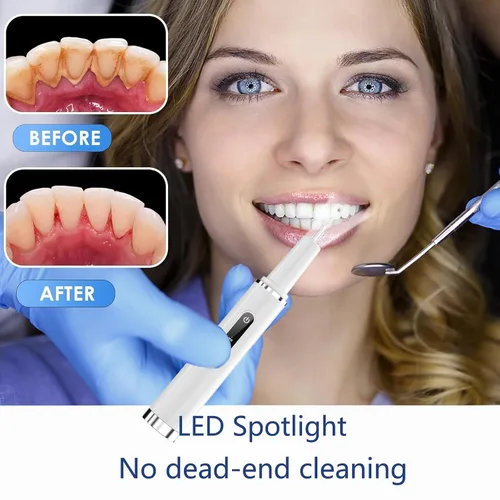 Vista 5 de Removedor de placa profesional para dientes, herramienta inteligente de limpieza de dientes activada por contacto