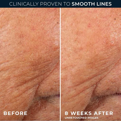 Vista 5 de RoC Retinol Correxion Line - Cápsulas de suero de noche suavizante, tratamiento diario antienvejecimiento para líneas finas, manchas oscuras