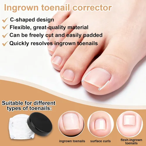 Vista 4 de Kit de 16 piezas de uñas encarnadas, con tiras transpirables para uñas de los pies en crecimiento, corrección de dedos curvos, parches de yeso sin