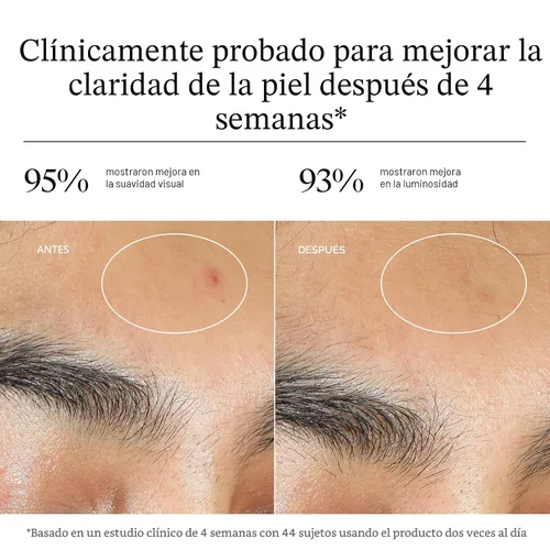 Vista 6 de Neutrogena Hidratante de gel para acné uniformemente transparente con ácido salicílico y N-acetil glucosamina, hidratante facial ligero y no grasoso
