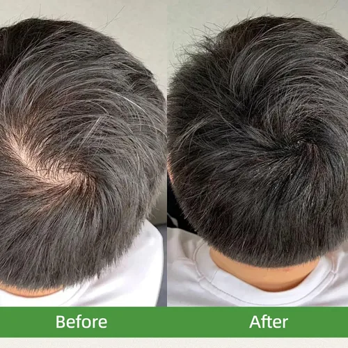 Vista 9 de Usma Grass - Barra de champú para adelgazar el cabello, champú sólido de rutina de jugo Usman para engrosar y oscurecer, pérdida de cabello